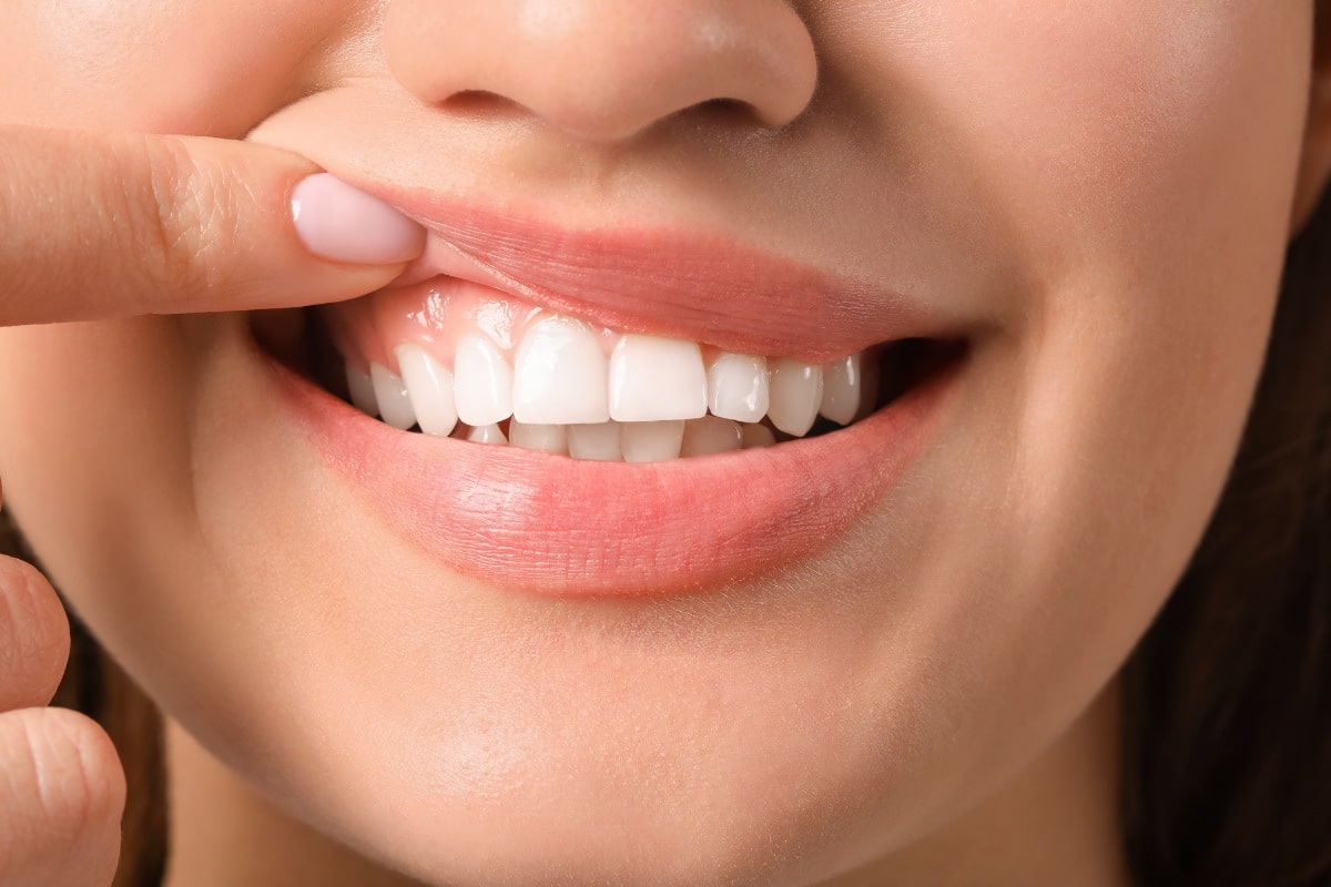 5 Signs Your Gums Need Help