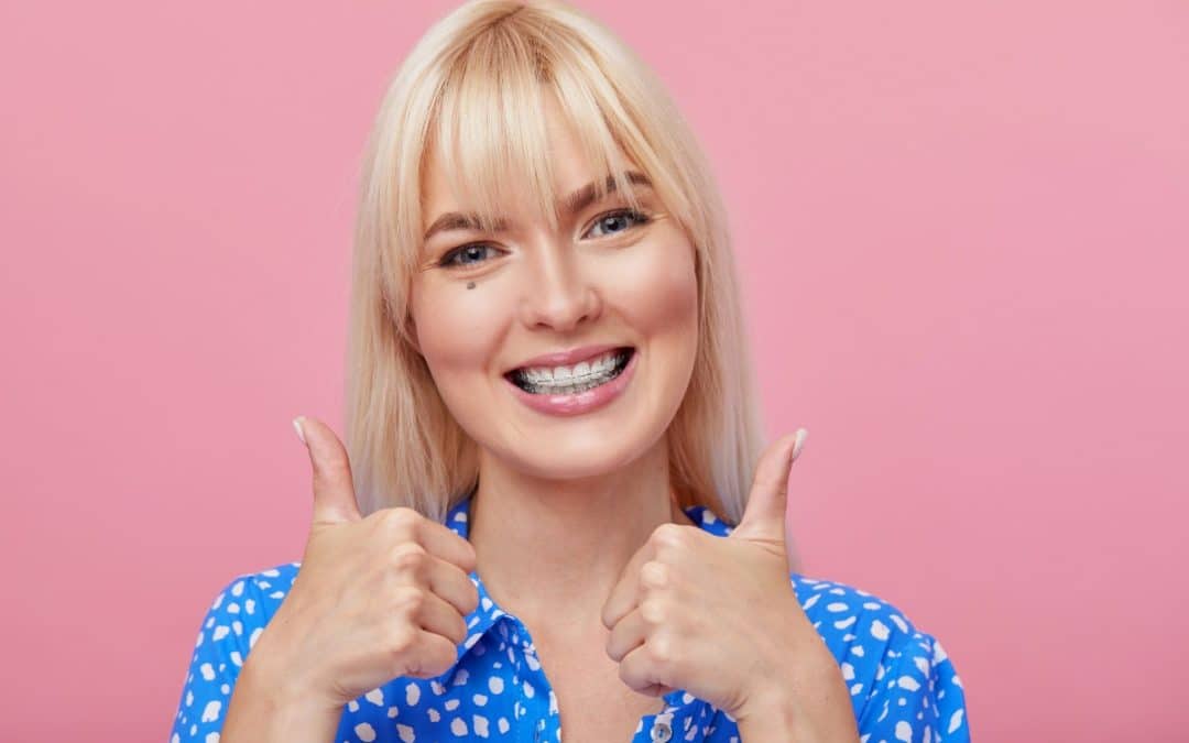 What You Need to Know About Nickel-free Braces