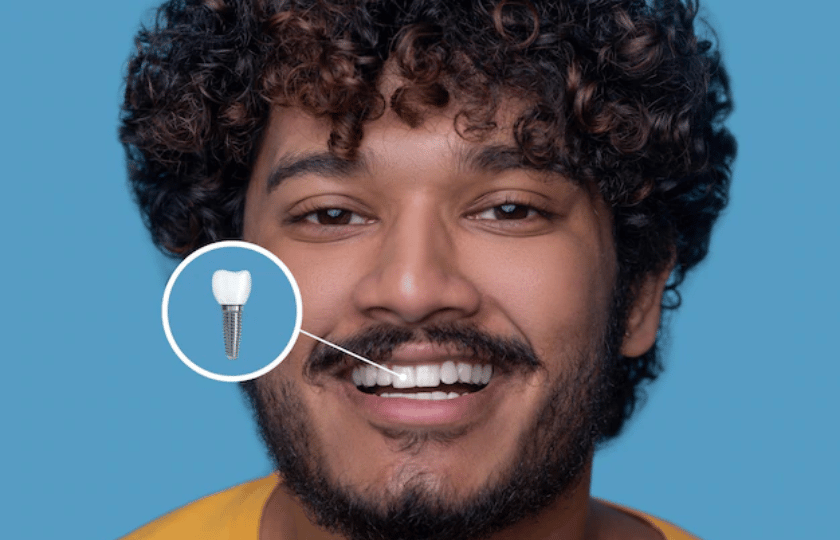 dental implants recovery tips post dental implant surgery recovery tips