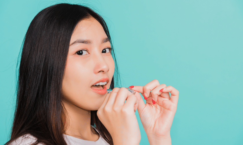 The Ultimate Guide to Oral Hygiene While Wearing Invisalign Aligners