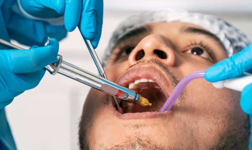 Understanding The Different Stages of the Root Canal Treatment Process