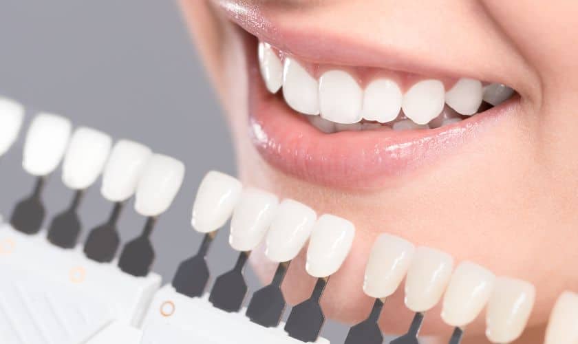 Brighten Your Smile: Teeth Whitening Techniques and Treatments in Rio Rancho