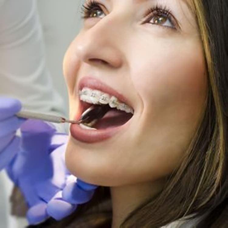 brace-and-orthodontics-services_lp-img