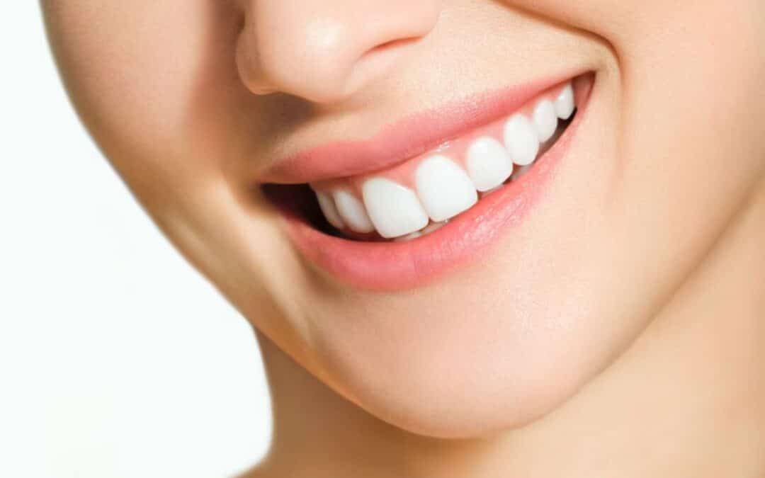 Teeth Whitening Tips: How to Achieve a Brighter Smile