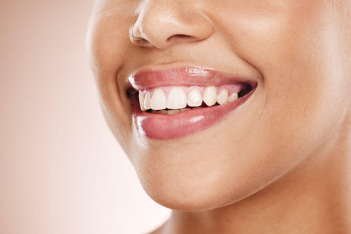 Cosmetic Dental Treatment Bright smile of a patient after cosmetic dental treatment.