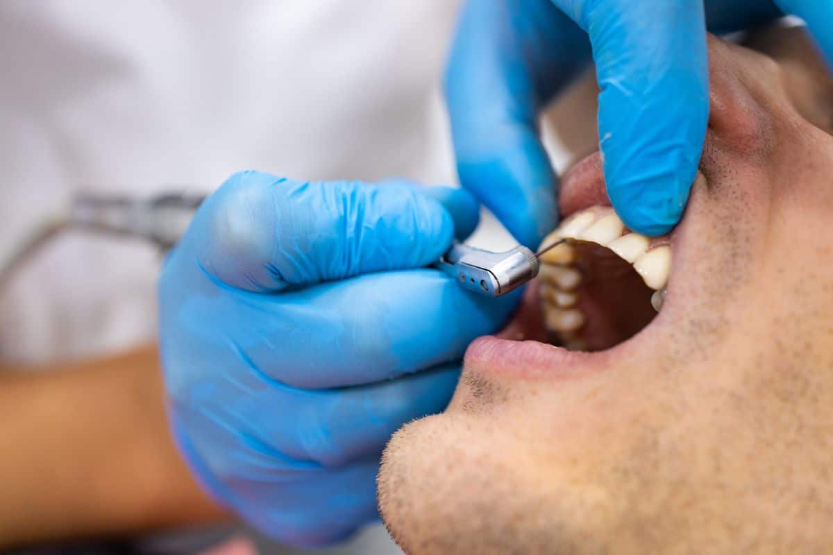 Bone Grafting A dentist performing a bone grafting procedure during oral surgery.
