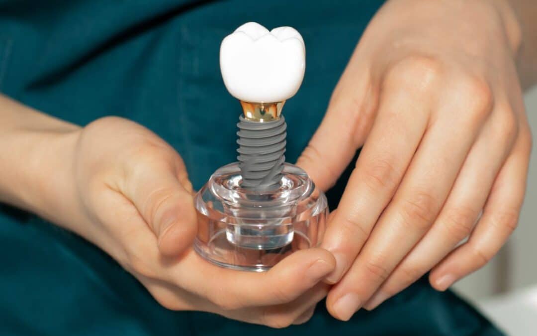 From Missing Teeth to Confident Smiles: Dental Implant Journeys in Rio Rancho