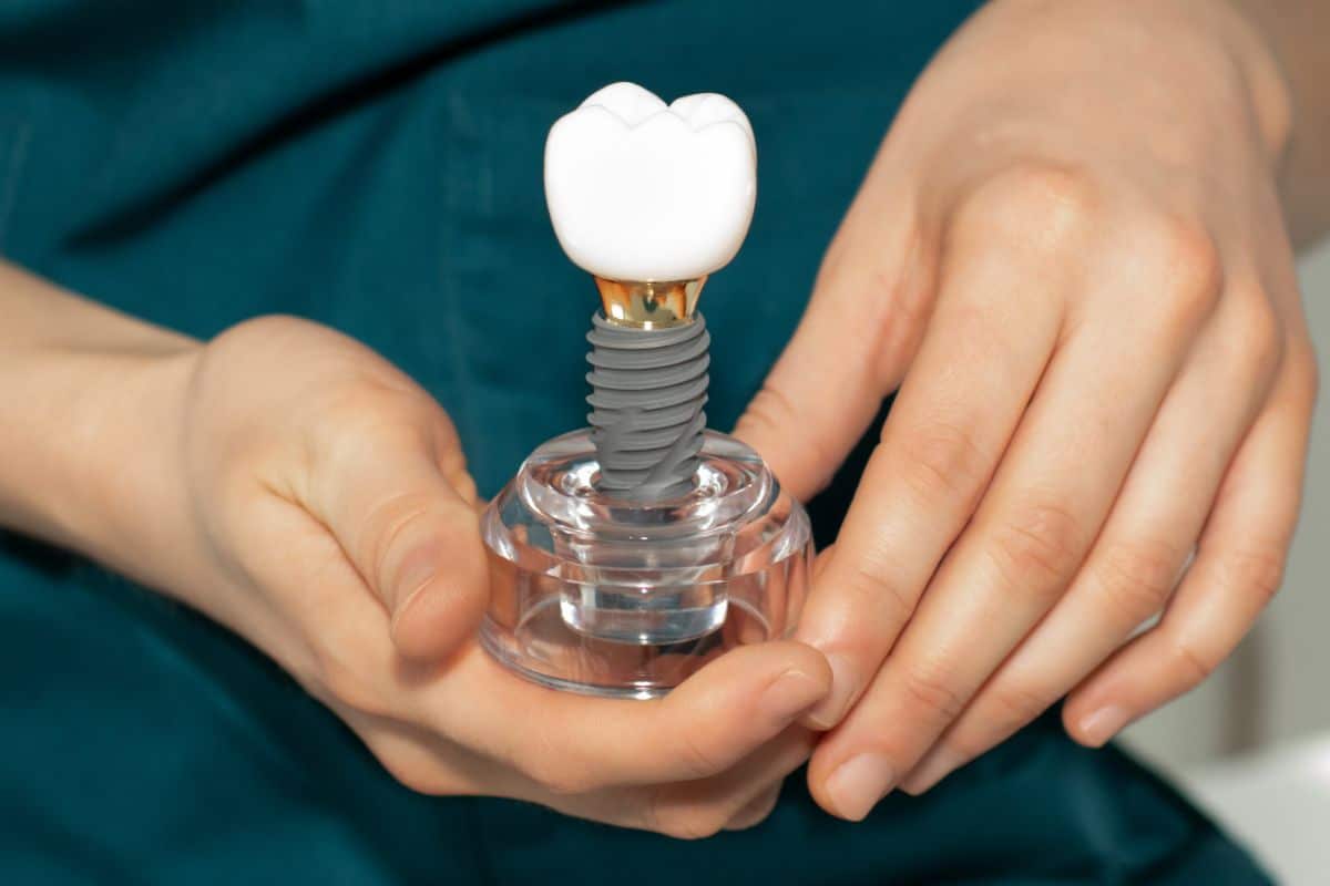 Dental Implants Dentist holding a dental implant model.