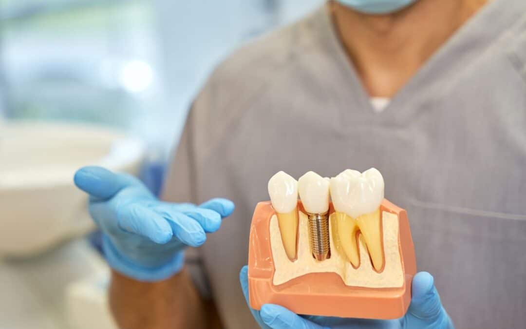 How Dental Implants Improve Your Confidence and Quality of Life