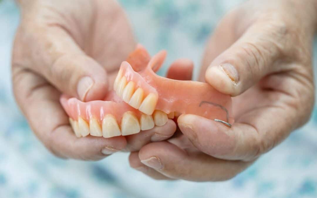 Denture Repair: How Often Should You Reline Your Dentures?