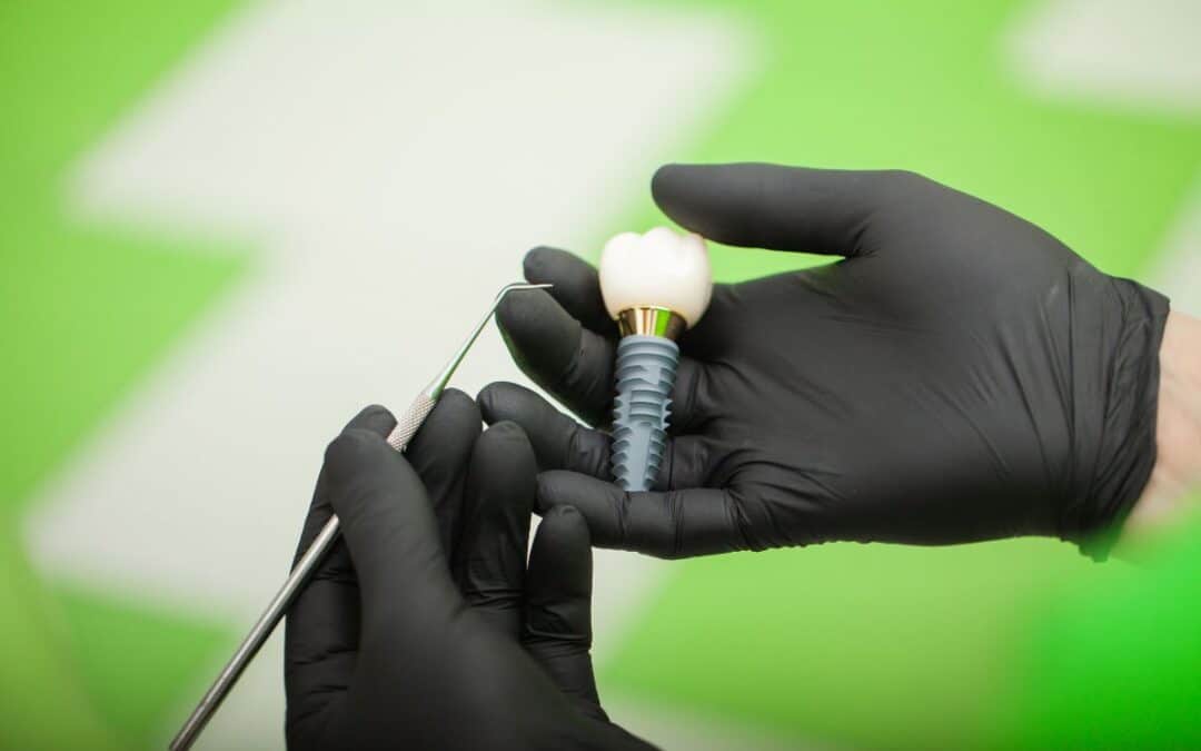 How to Handle Discomfort After Dental Implant Surgery