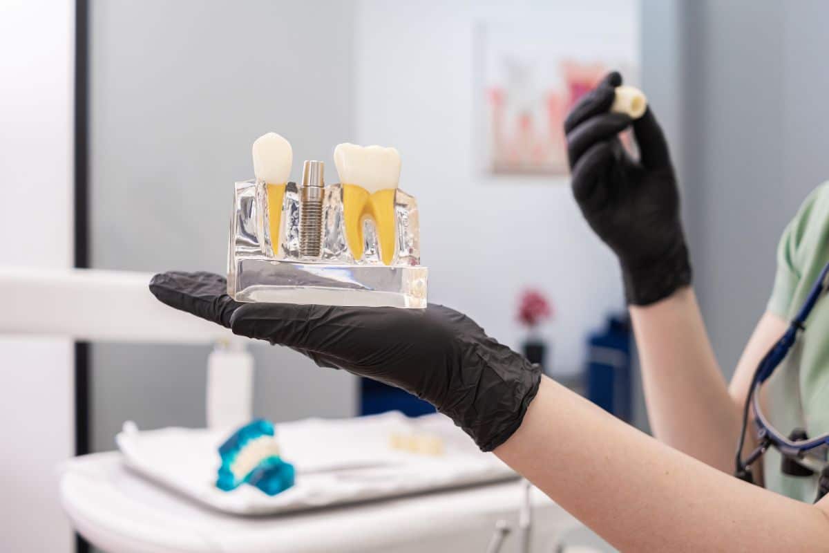 Dentist explaining a dental implant model to ease patient anxiety.