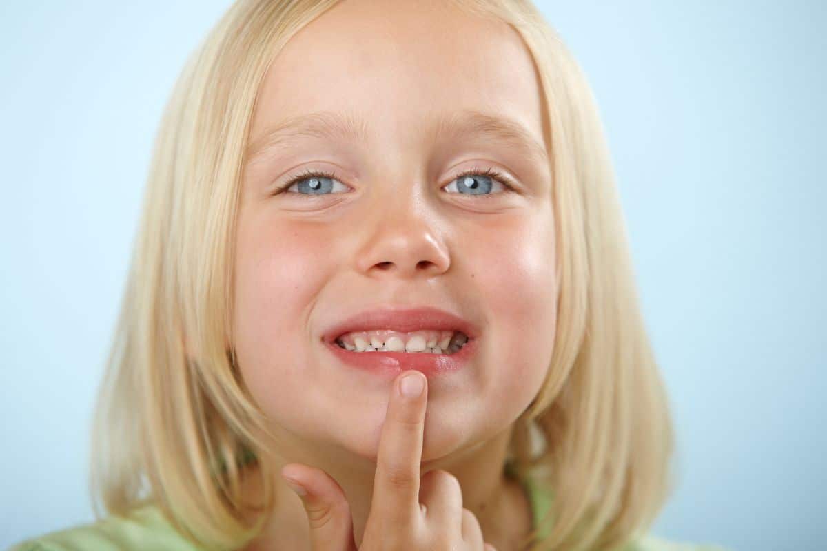 Child pointing to teeth while smiling to show early signs of dental health concerns caused by sugary drinks.